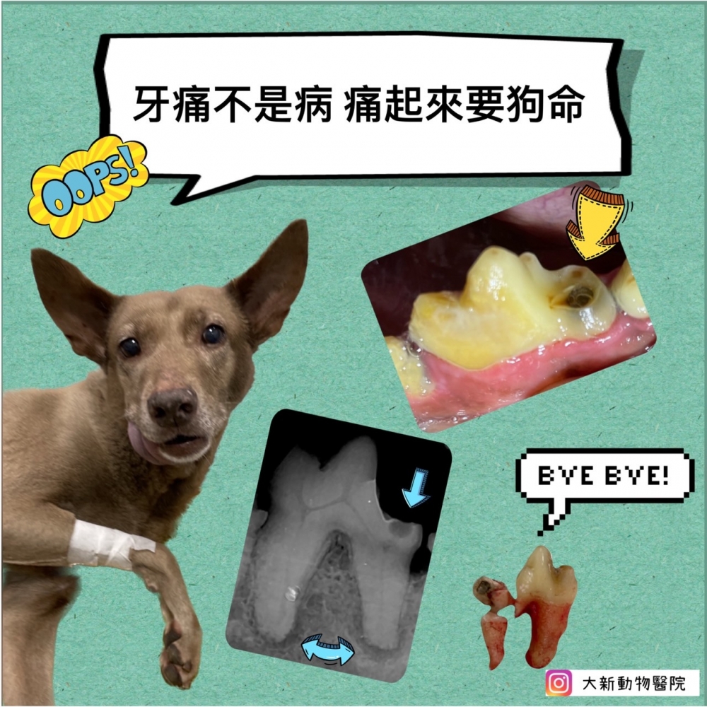 ☀根管治療
☀補牙
☀牙周再生治療
☀全口牙科x光